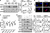 MMP12-dependent myofibroblast differentiation of human NPC.