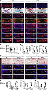 Inhibition of NP fibrosis and myofibroblast formation in Mmp12–/– mice.