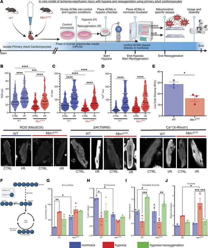 
Mpc1CKO cardiomyocytes under simulated I/R exhibit greater mitochondria...