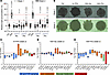 Pro and Ibu induce lipid accumulation in human 3D liver spheroids by alteri