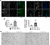 Nedd4 regulates mHtt aggregation and toxicity in primary cortical neurons.