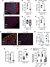 Epithelial HO-1 regulates oxidative damage, iron levels, and stress adaptat