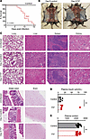 Prothrombin is required for survival of mice during chronic virus infection