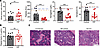 Prothrombin prevents severe anemia following chronic virus infection.