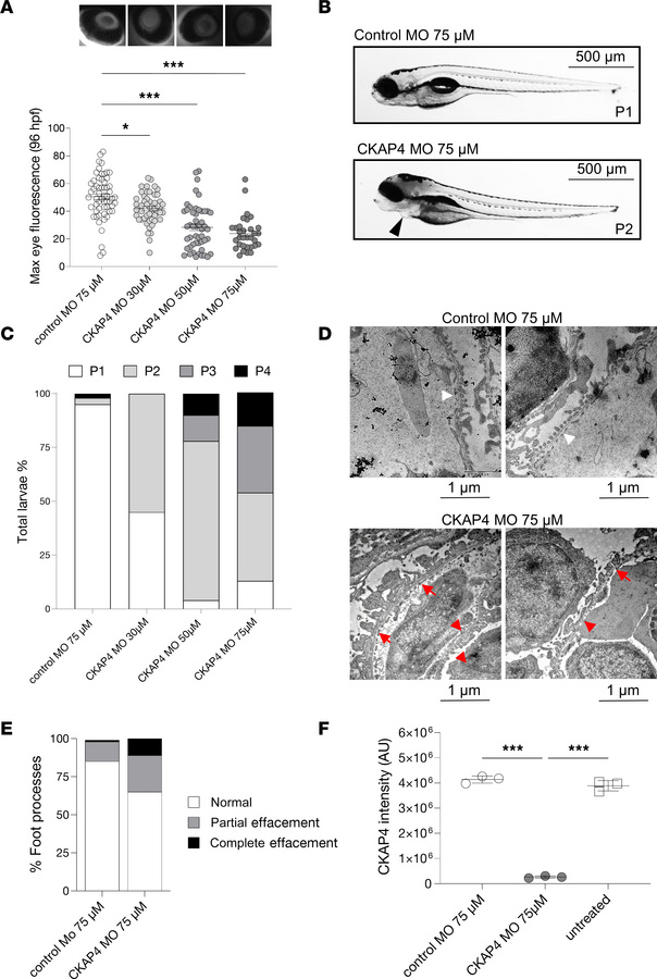 CKAP4 zebrafish homolog knockdown causes proteinuria and podocyte FPE.
C...