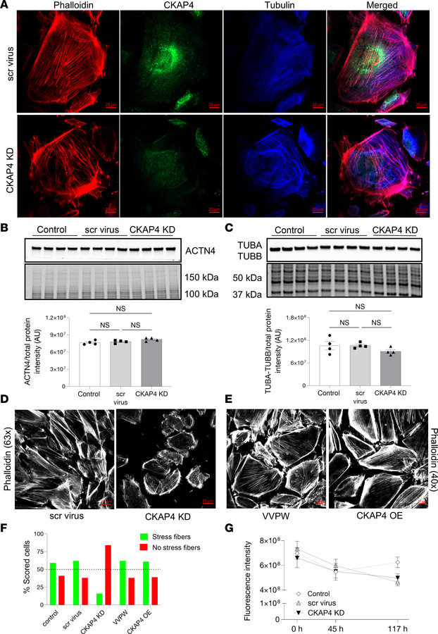 CKAP4 KD in HPODs in vitro alters the cytoskeleton.
Immunofluorescence s...