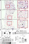 CKAP4 is downregulated in glomeruli in patients with DKD.