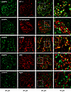 CKAP4 is expressed in all glomerular cell types in human glomeruli.
