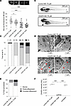 CKAP4 zebrafish homolog knockdown causes proteinuria and podocyte FPE.