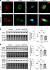 CKAP4 KD in vitro influences the shape of the ER in HPODs.