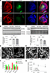 CKAP4 KD in HPODs in vitro alters the cytoskeleton.