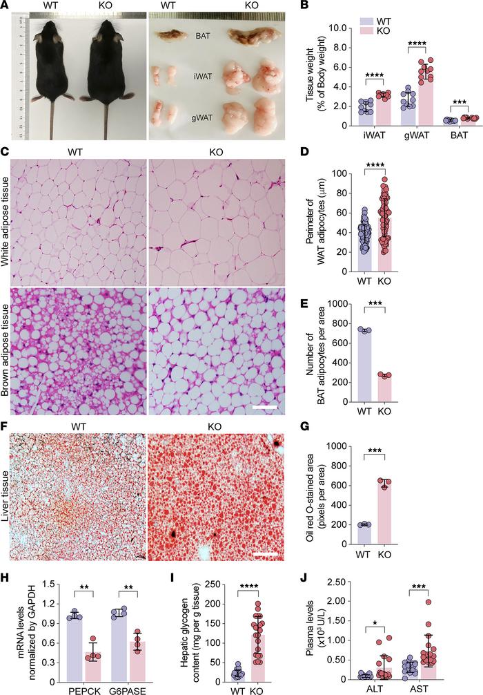 Trappc9-deficient mice develop obesity and NAFLD.
(A) Comparison of Trap...