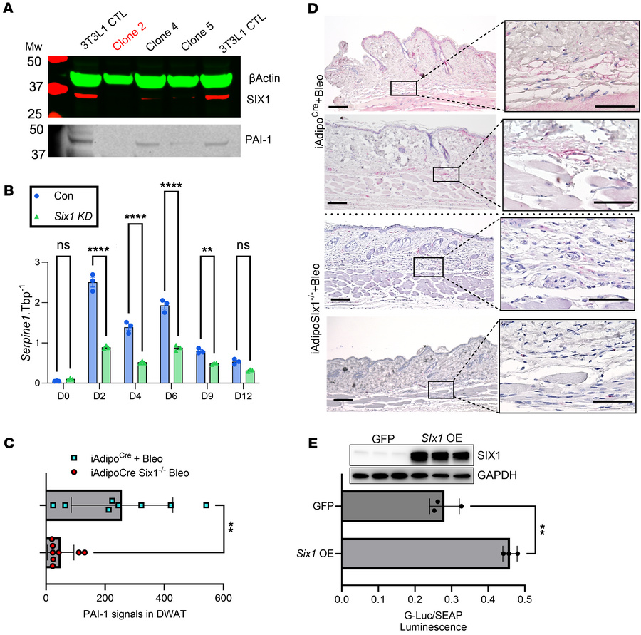 PAI-1 levels are upregulated in bleomycin-induced skin fibrosis and trac...