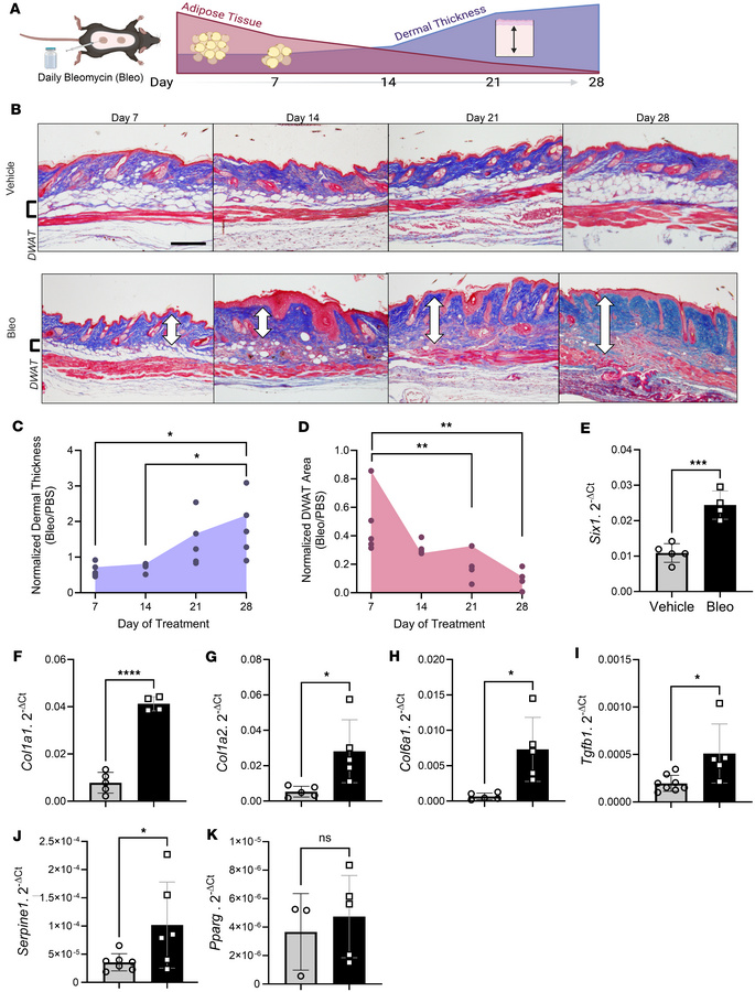 Dermal white adipose loss precedes fibrosis in the murine model of bleom...
