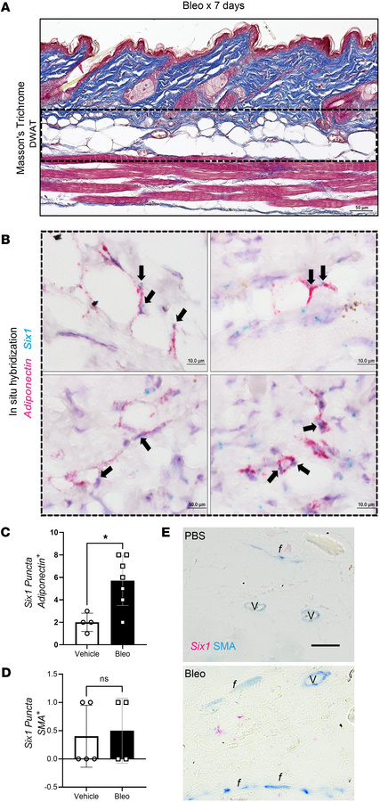 Adipocyte Six1 expression precedes white adipose loss in s.c. bleomycin-...