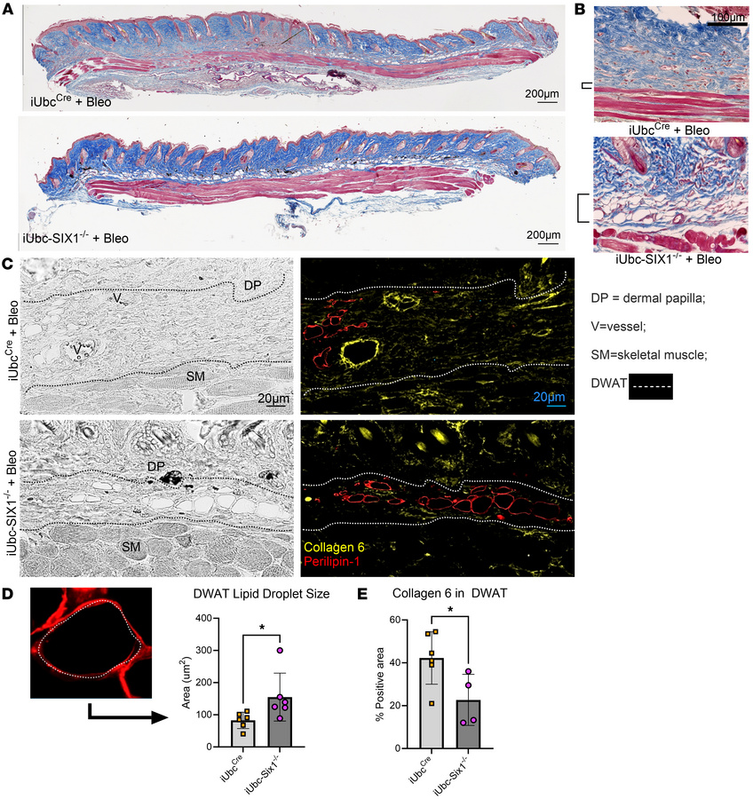 Global Six1 deletion prevents lipolysis and collagen 6 accumulation indu...