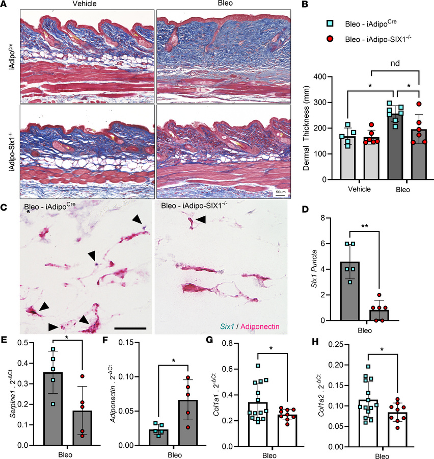 Adipocyte SIX1 deletion prevented bleomycin-induced dermal white adipose...