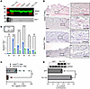PAI-1 levels are upregulated in bleomycin-induced skin fibrosis and track w