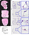 Dermal White Adipose Tissue (DWAT) atrophy and increased adipocyte SIX1 exp