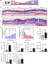 Dermal white adipose loss precedes fibrosis in the murine model of bleomyci
