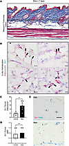Adipocyte Six1 expression precedes white adipose loss in s.c. bleomycin-tre