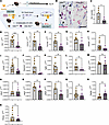 Inducible global deletion of Six1 inhibits fibrotic gene expression in s.c.