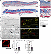 Global Six1 deletion prevents lipolysis and collagen 6 accumulation induced