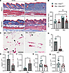 Adipocyte SIX1 deletion prevented bleomycin-induced dermal white adipose at