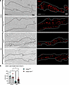 Lipid droplets are preserved in bleomycin-treated adipocyte-Six1–deficient