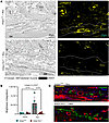iAdipoCre -Six1 KO mice have decreased collagen 6 deposition in the DWAT af