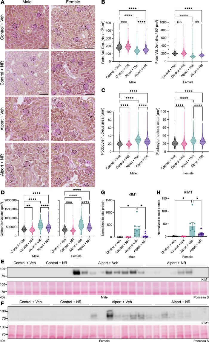 NAD+ supplementation prevents both glomerular and tubular injury in Alpo...