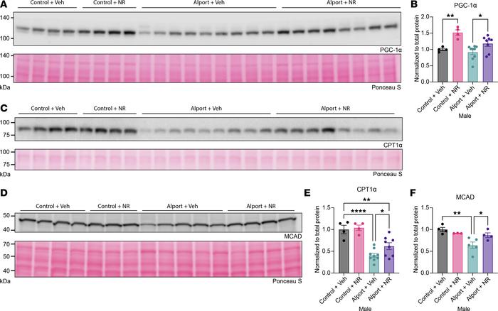 NAD+ supplementation activates renal fatty acid metabolism.
(A and B) NR...