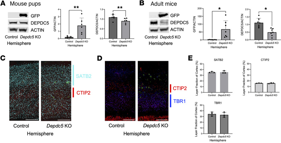 Confirmation of DEPDC5 loss without cortical migration defects in postna...