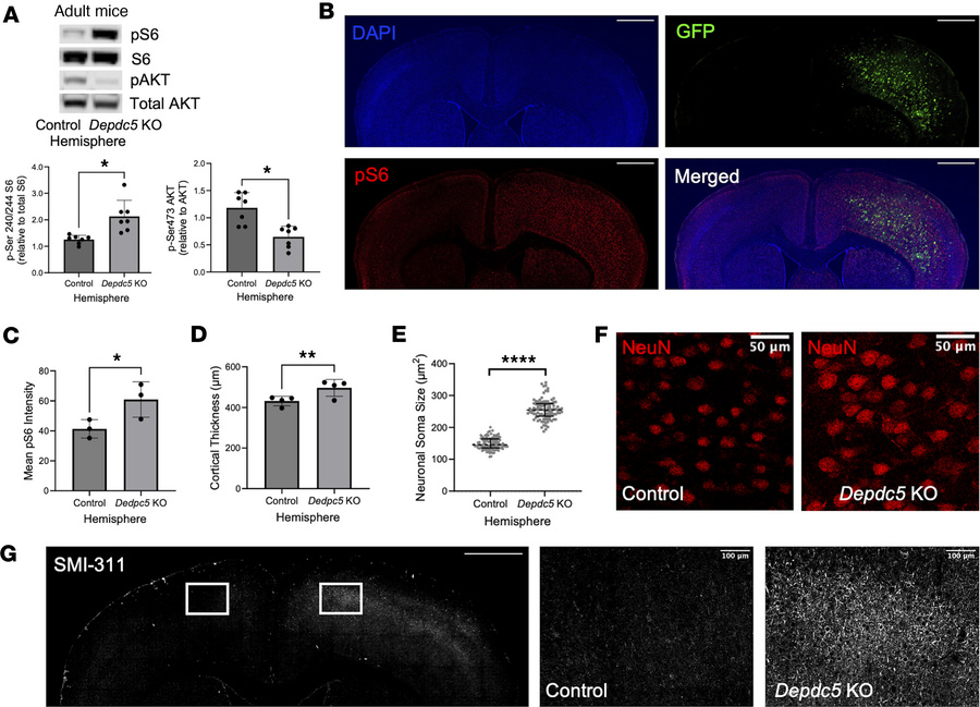 Cortical injection of AAV-Cre-GFP shows clear neuropathological effects ...