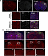 Evidence of glial abnormalities in postnatal focal Depdc5-knockout mice.