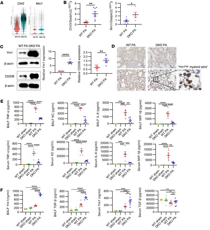 Resolution of inflammation prompted by Chil3+ myeloid cells through diff...