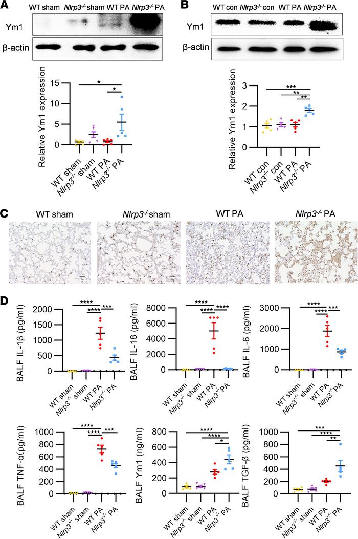 Validation of the NLRP3/Ym1 axis in Nlrp3-KO mice.
(A) Western blot anal...