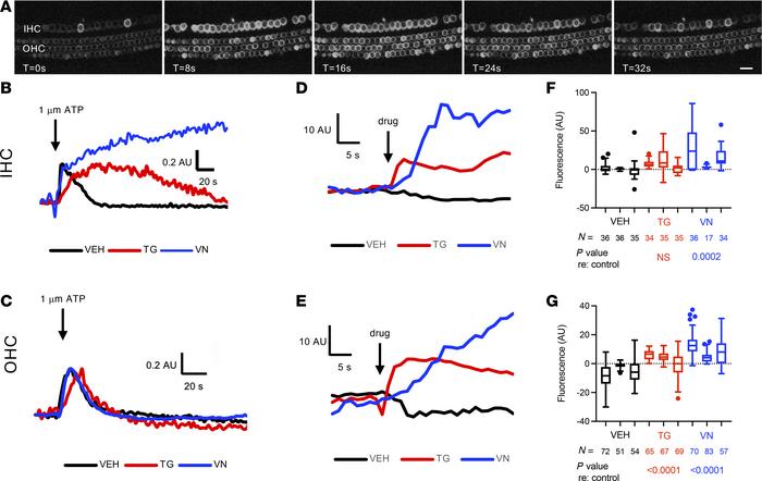 Ca2+ activity in neonatal cochlear hair cells.
(A) Live imaging of Myo15...
