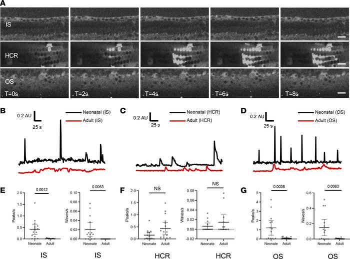 Ca2+ activity in adult cochlear supporting cells.
(A) Live imaging of So...
