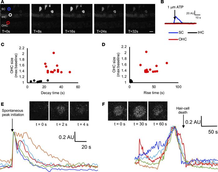 Live imaging of Myo15Cre-GCaMP6f adult cochlea.
(A and B) In the adult c...