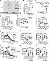 Mitochondrial respiratory failure is driven by succinylation-induced NAD+ d