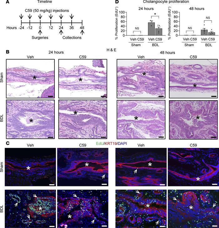 Inhibition of WNT ligand secretion leads to decreased cholangiocyte prol...
