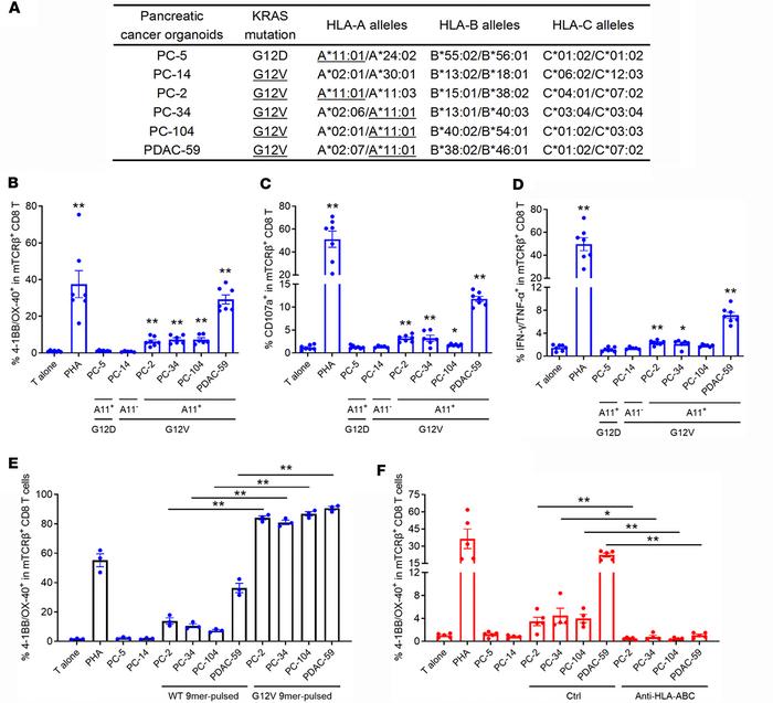 TCR-001–transduced T cells specifically recognized human pancreatic canc...