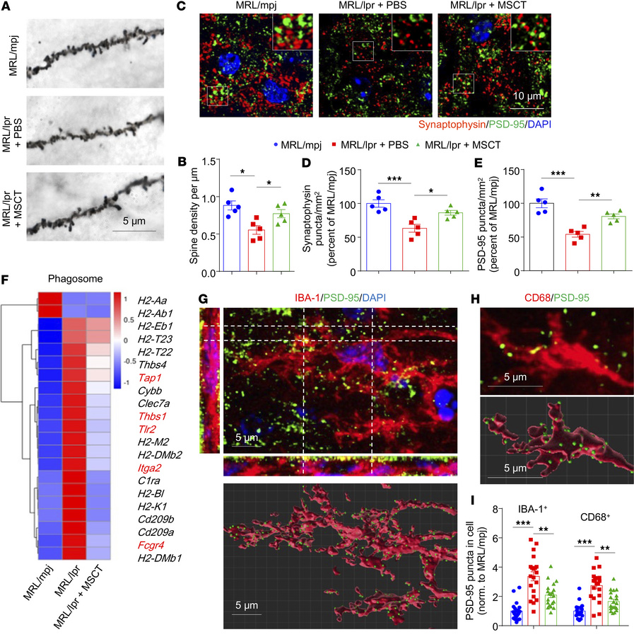 MSCT inhibits microglia-mediated synaptic stripping to rescue dendritic ...