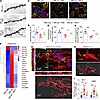 MSCT inhibits microglia-mediated synaptic stripping to rescue dendritic los