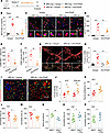 Blockage of IFN-γ signaling rescues depression phenotypes in MRL/lpr mice.
