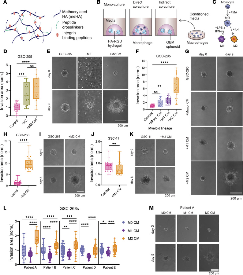 An engineered biomaterials platform to enable investigation of GBM-macro...