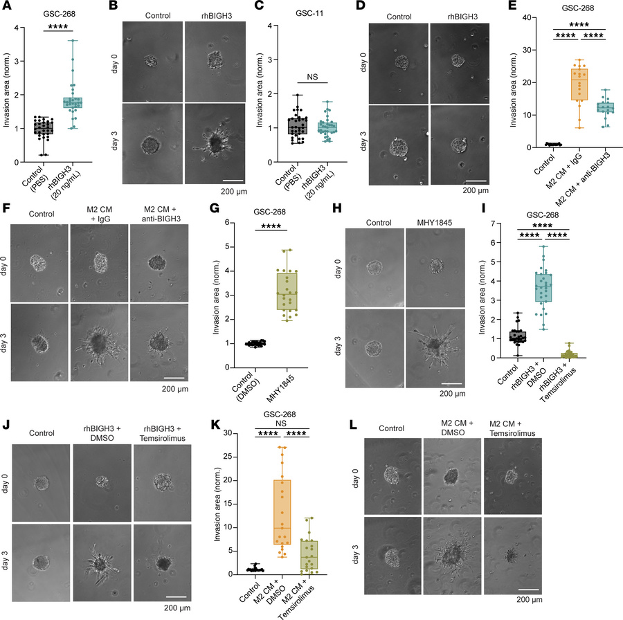 M2 macrophage–induced GSC invasion is mediated by secreted BIGH3 and is ...
