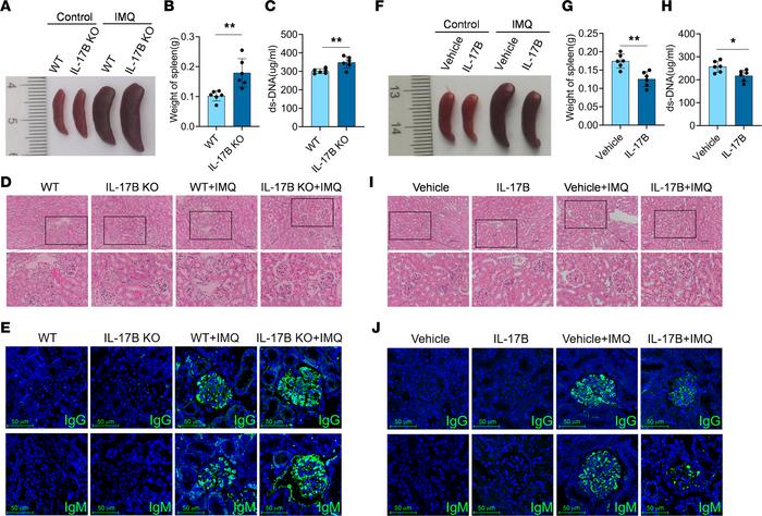 IL-17B attenuates IMQ-induced disease progression in mice with lupus.
(A...