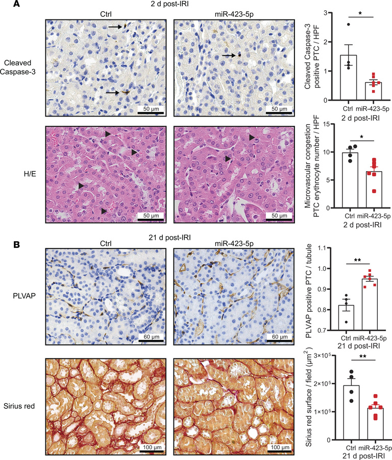 miR-423-5p attenuates microvascular injury and fibrogenesis after acute ...